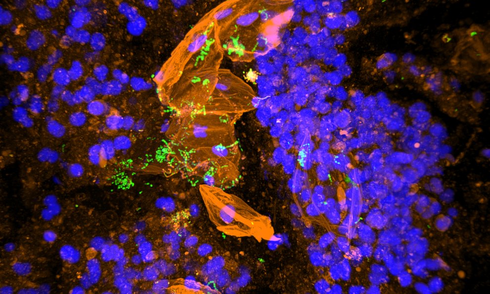 Illustration of MiPACT-HCR, a tissue-clearing technique designed for bacterial retention and identification