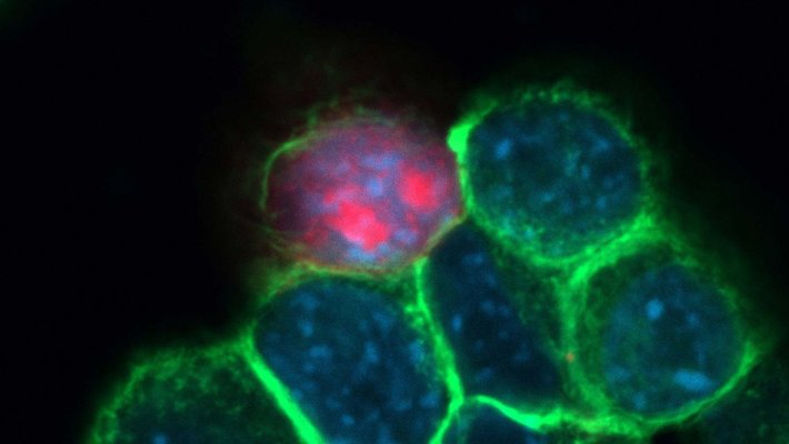 Cancer Cells