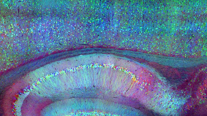 Brain Circuits