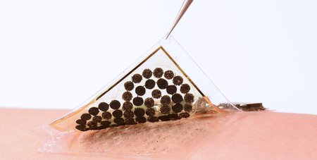 Electronic Skin
