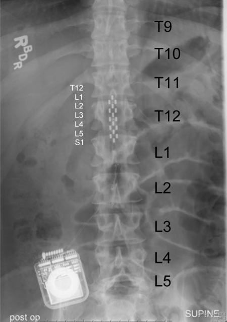 xray-spine.jpg