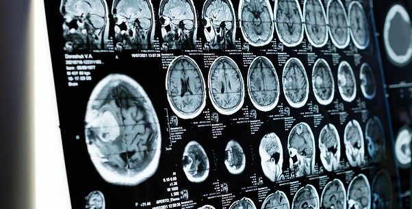 An image of a long set of CT scans