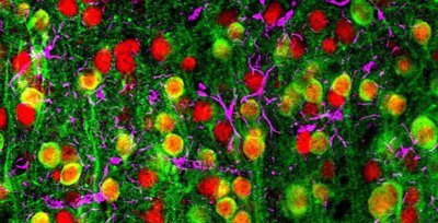 brain mapping