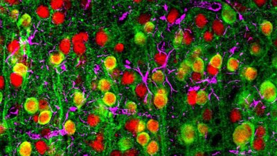 brain mapping