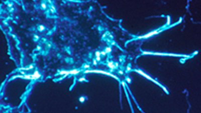 blue cancer cell