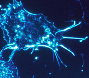 blue cancer cell