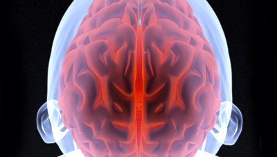 brain image