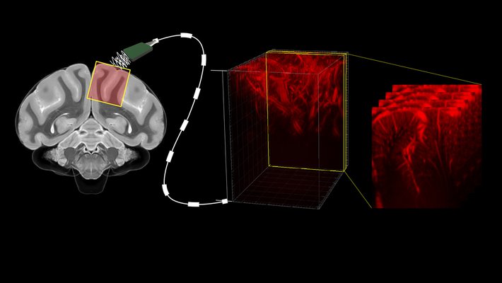 A diagram illustrating a brain connected to a cable, that reads out brain activity and creates maps of the brain's vasculature.