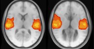 brain imaging