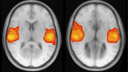 brain imaging