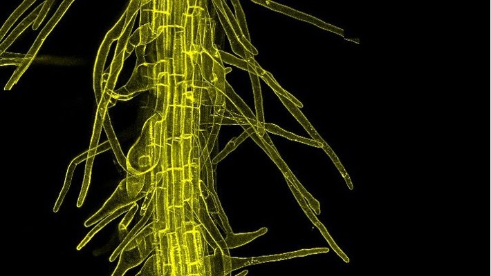 A glowing yellow tubular structure on black background