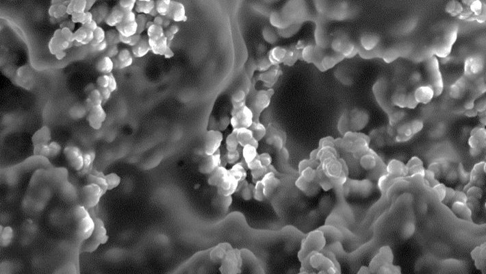 Hydrogel