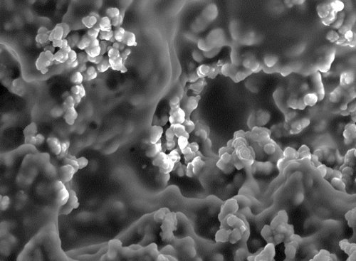 Hydrogel