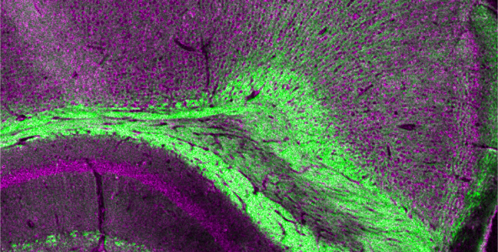 A region of a mouse imaged by the dual-laser microscopy technique. It is a purple and green cross section of tissue.