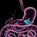 illustration of chip in gut