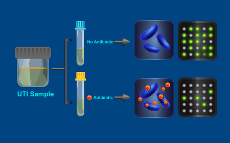 A visualization of how the antibiotic resistance test works.