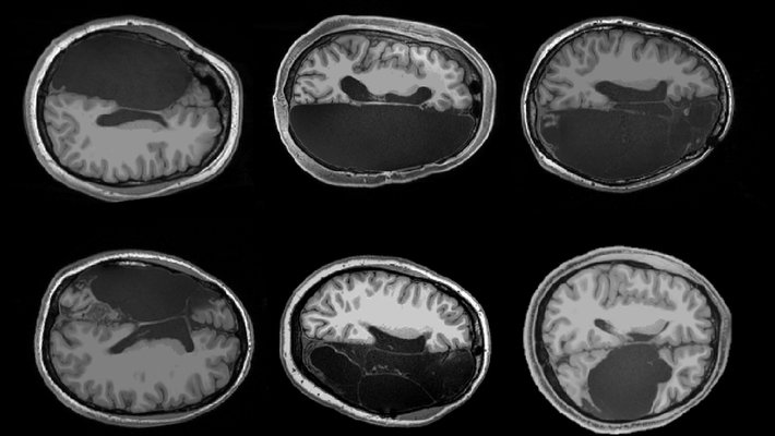 Six brain scans
