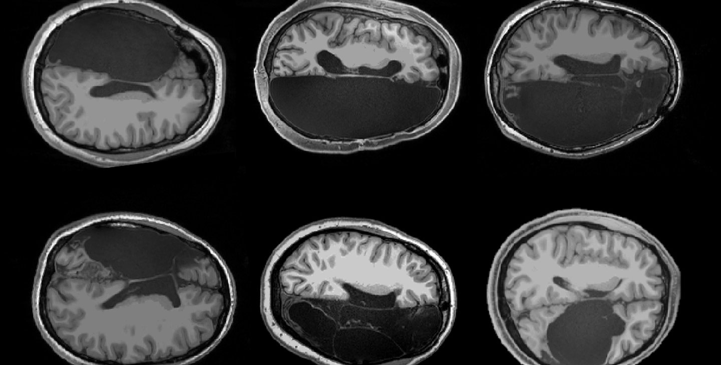 Six brain scans