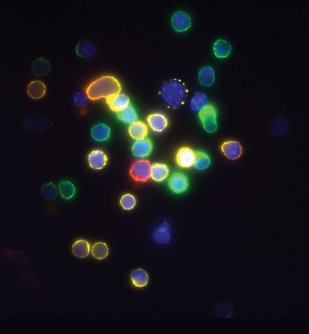 Fluorescence-labeled immature T cells