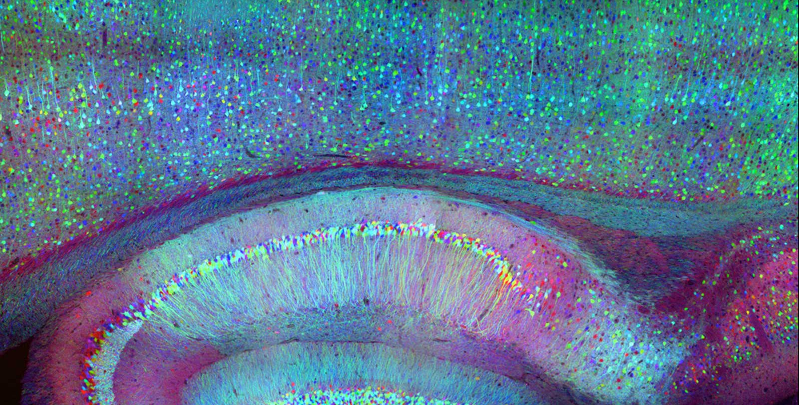 Brain image