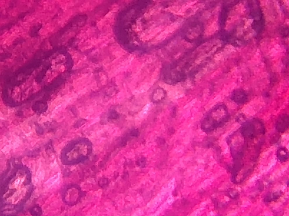 Onion skin seen at 300x magnification